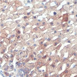 StAR antibody [HL1360] (GTX636800)