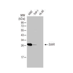 StAR antibody [HL1360] (GTX636800)