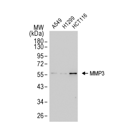 MMP3 antibody [N3C1], Internal (GTX100723)