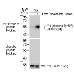 LYN (phospho Tyr397) antibody [HL122] (GTX635694)