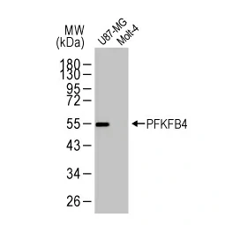 PFKFB4 antibody [HL2204] (GTX638208)