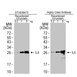 IL-6 antibody [HL1168] (GTX636473)