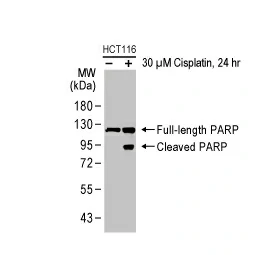 PARP antibody [HL1364] (GTX636804)