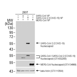 SARS-CoV-2 (COVID-19) Nucleocapsid antibody [HL344] (GTX635679)