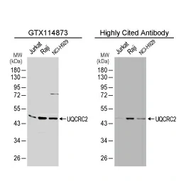 UQCRC2 antibody 
(GTX114873)