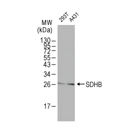 SDHB antibody (GTX113833)