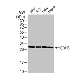 SDHB antibody [HL2251] (GTX638300) 