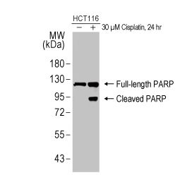 PARP antibody [HL1364] (GTX636804)