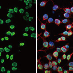 PARP antibody [HL1364] (GTX636804)