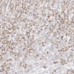 PARP antibody [HL1364] (GTX636804)