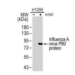 Influenza A virus PB2 protein antibody (GTX125926)