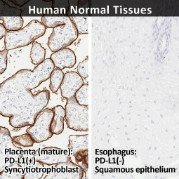 PD-L1 antibody [HL1041] (GTX635975)