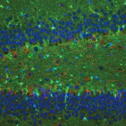 Detection of S100 beta in glial cells in paraffin-embedded rat hippocampus tissue.