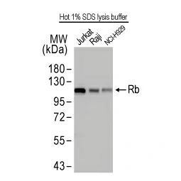 Rb antibody [HL2465] (GTX638814)