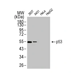 p53 antibody [HL2242] (GTX638291)