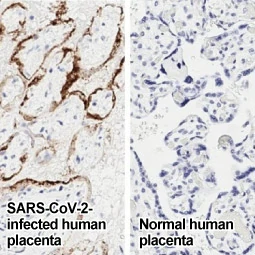 SARS-CoV-2 (COVID-19) Nucleocapsid antibody [HL344] (GTX635679)