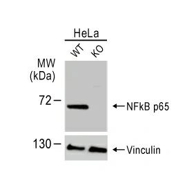 NF-kB p65 antibody (GTX102090)