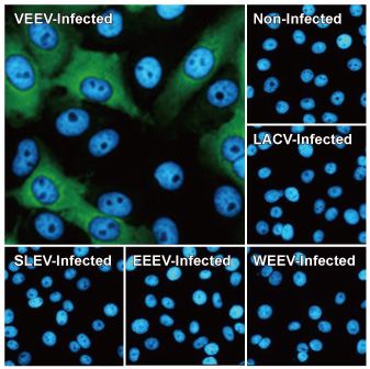 Venezuelan Equine Encephalitis Virus nsP2 antibody [HL1919] (GTX637668)