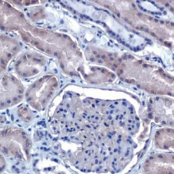 VEGFA antibody [HL1755] (GTX637405)

