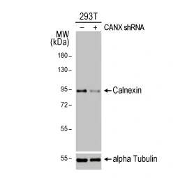 Calnexin antibody [HL1598] (GTX637077)