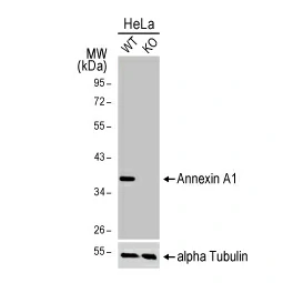 Annexin A1 antibody [HL2141] (GTX638119)