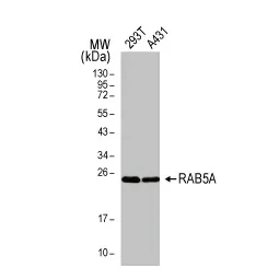 RAB5A antibody [HL1497] (GTX636971)