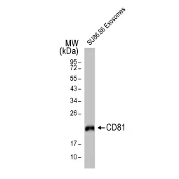 CD81 antibody [HL1666] (GTX637264)