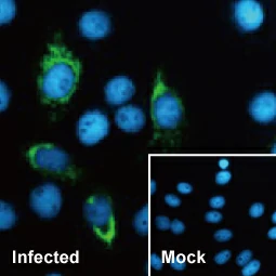 Zika virus NS4B protein antibody [HL1663]  (GTX637261)