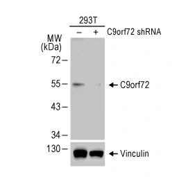 C9orf72 antibody [GT779] (GTX632041)