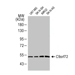 C9orf72 antibody [GT779-RB] (GTX635397)
