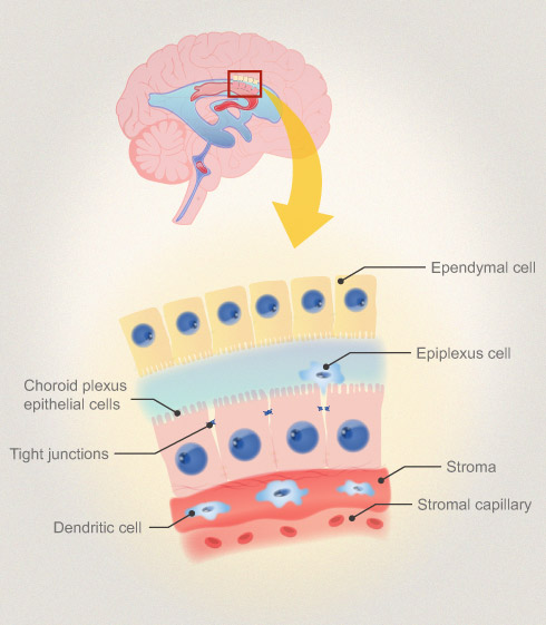 胆固醇载体也可以治疗阿尔茨海默氏症