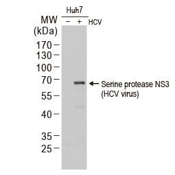 HCV NS3 protein antibody (GTX131269) C