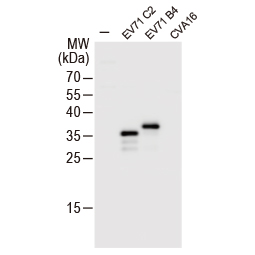 Enterovirus 71 VP1 antibody (GTX132339)