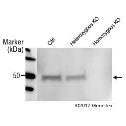 C9orf72 antibody [GT779] (GTX632041)