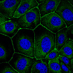 ICC/IF staining of the canine cell line MDCK with ZO-1 antibody – VetSignal™ (GTX135089)