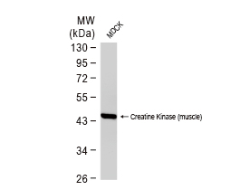 Creatine kinase (muscle) antibody - VetSignal™ (GTX134955)
