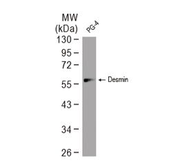 Desmin antibody-VetSignal™ (GTX134990)

