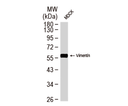 Vimentin antibody-VetSignal™ (GTX135083)
