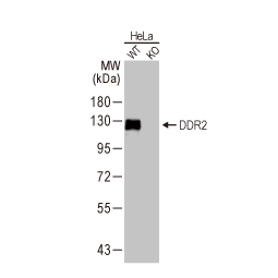 DDR2 antibody [HL1107] (GTX636322)