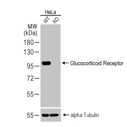 Glucocorticoid Receptor antibody [HL1151] (GTX636422)