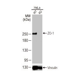 ZO-1 antibody [HL1185] (GTX636491)