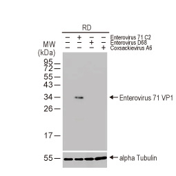 Enterovirus 71 VP1 antibody [HL1929] (GTX637688)