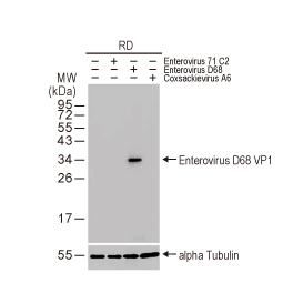 Enterovirus D68 VP1 antibody [HL1997] (GTX637898)