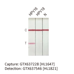 Human Papillomavirus type 16 E7 antibody [HL1647] (GTX637228)
