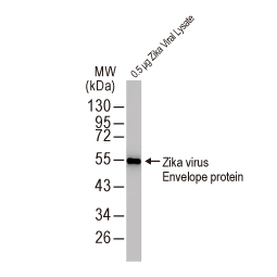 Zika virus Envelope protein antibody HL1699] (GTX637298)