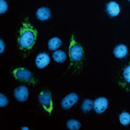 Zika virus NS4B protein antibody HL1663] (GTX637261)