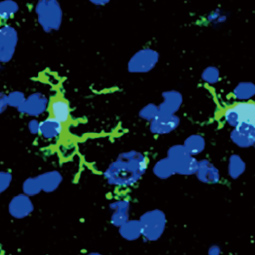 Iba1 antibody [HL22] (GTX635363)