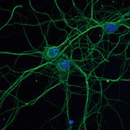 beta Tubulin 3/ Tuj1 antibody [HL1709] (GTX637308)