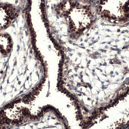 Estrogen Receptor alpha antibody HL1082] (GTX636203)
