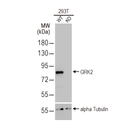 GRK2 antibody [HL1562] (GTX637038)